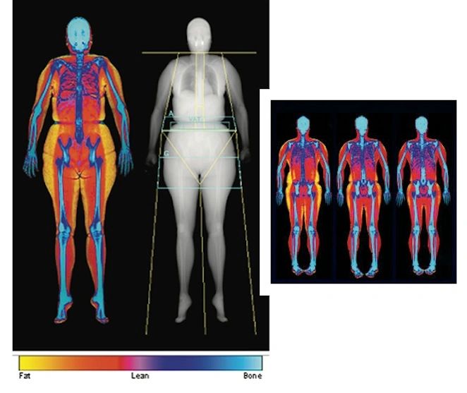 DexaFit body composition scan for cellular health